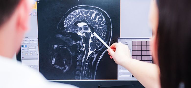 Belleville Brain Injury Lawyers | What To Do If You Have Symptoms